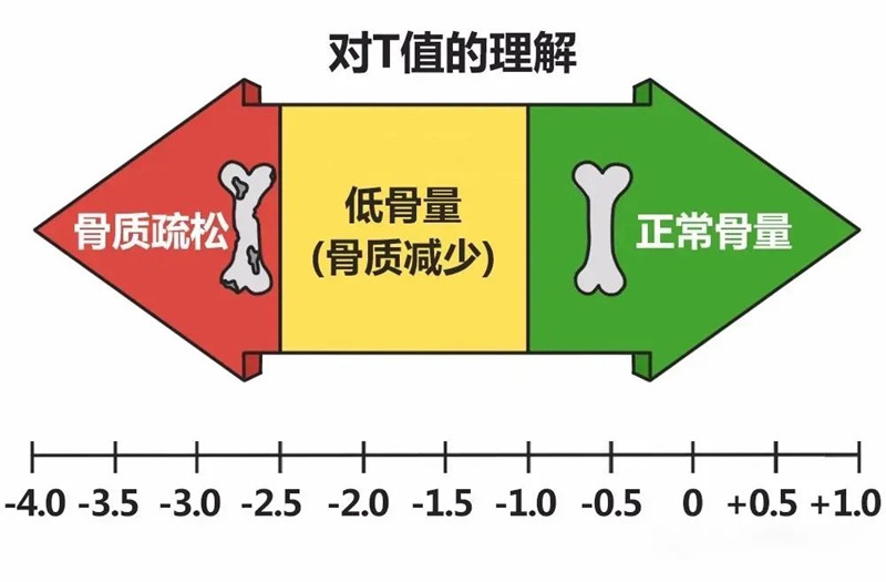 骨密度儀檢測(cè).jpg